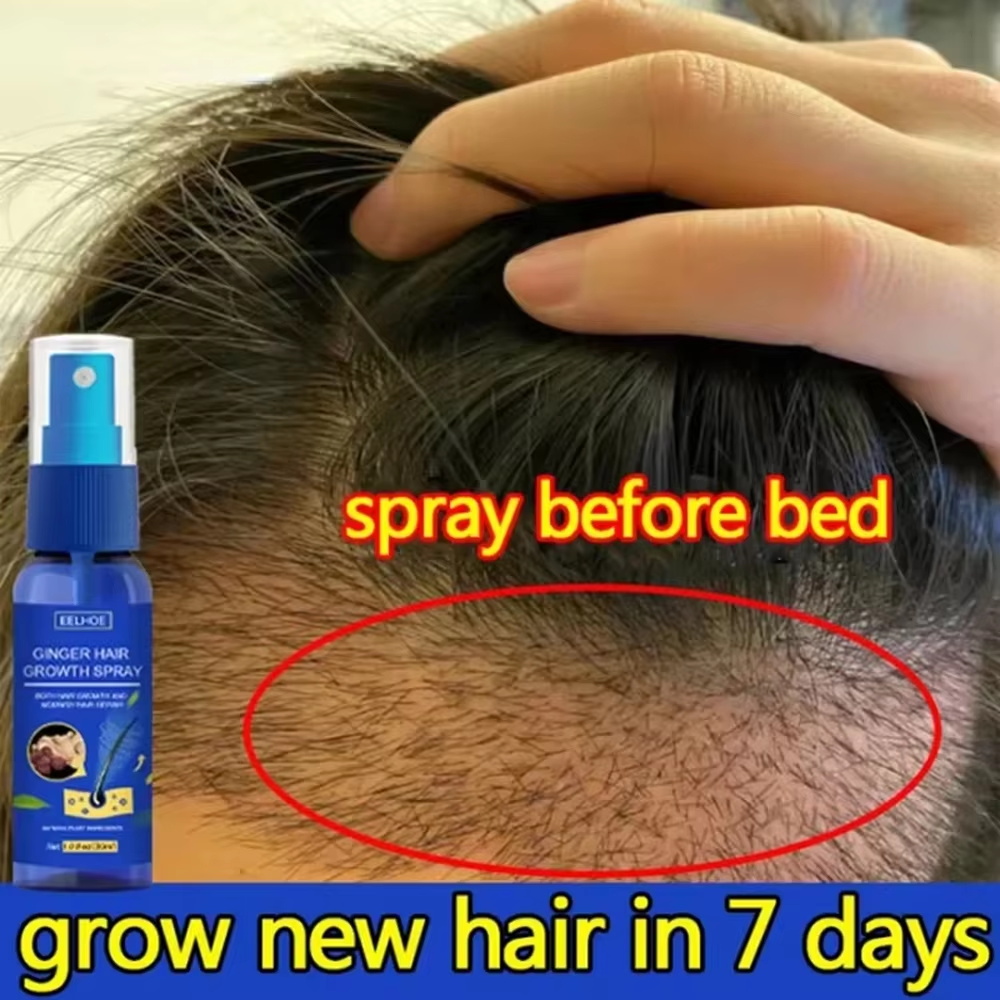 Ingrown Hair Serum - Schnelles Ingwer-Haarwuchsspray für Wurzelwachstum, Anti-Haarausfall, Haarwuchs-Serum,