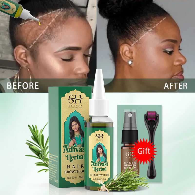 Ayurvedisches Haarwuchsöl Indi – Ingrown Hair Serum Bewertung und Preis