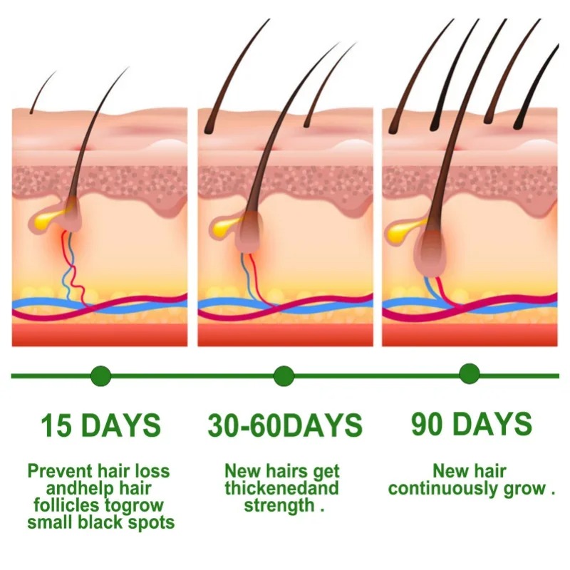 Haarwachstumsserum, schnell wa – Ingrown Hair Serum Bewertung und Preis
