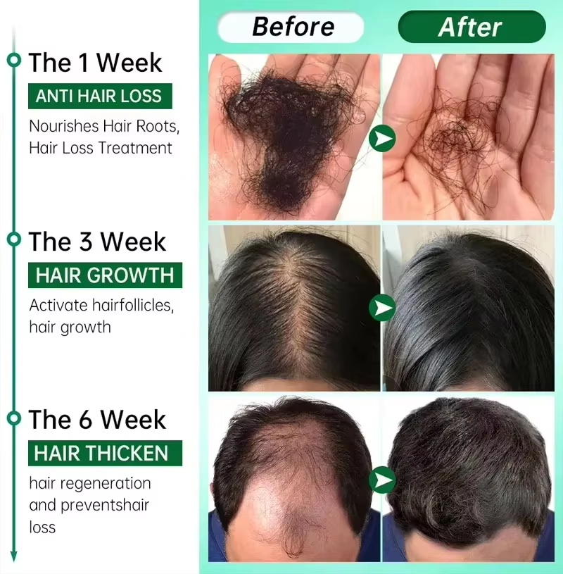 Haarwuchsserum, 7 Tage schnell – Ingrown Hair Serum Bewertung und Preis