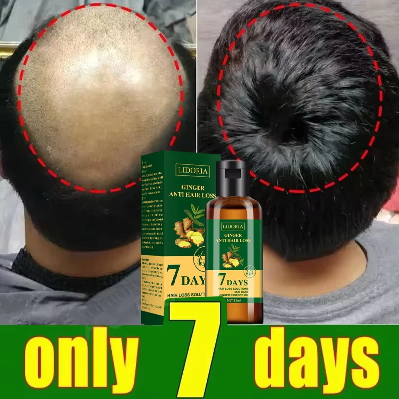 Haarwuchsserum, 7 Tage schnell – Ingrown Hair Serum Bewertung und Preis