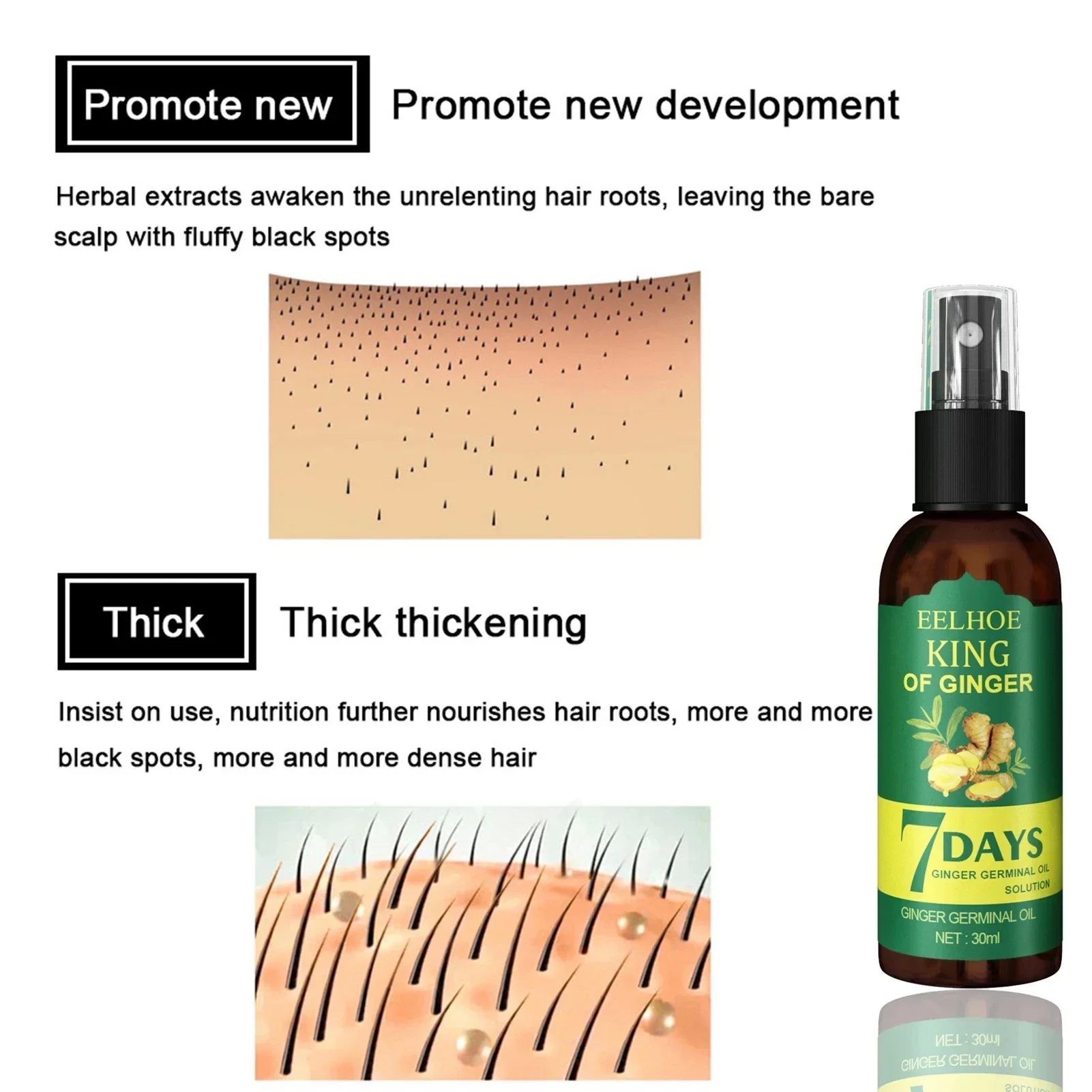2024 Ingwer Haarwuchs Serum Sp – Ingrown Hair Serum Bewertung und Preis