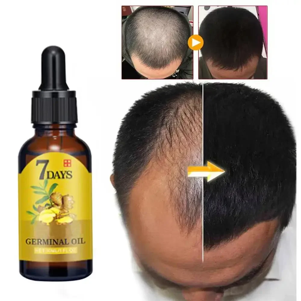 Haarwachstums-Ingwer, schnell  – Ingrown Hair Serum Bewertung und Preis